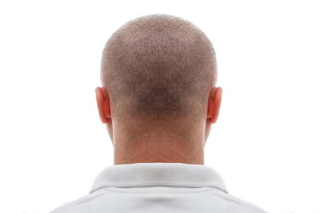 Hair Transplant Care Hair Transplant Surgery